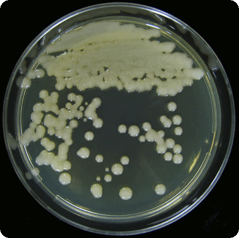 Cryptococcus vaga test warszawa