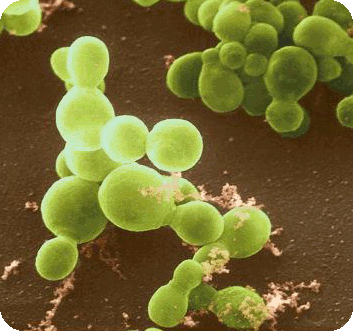 Malassezia  furfur warszawa vegatest drożdżaki zapalenie łojotokowe